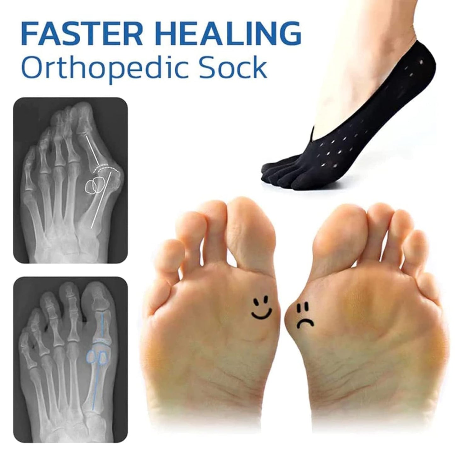 Aster 5 Pairs Orthopedic Toe Compression Socks Toe Socks for Women No Show Align Toe Socks for Bunion Low Cut Liner Five Finger Socks with Gel Tab Athletic Breathable Toe Separator Socks for Women