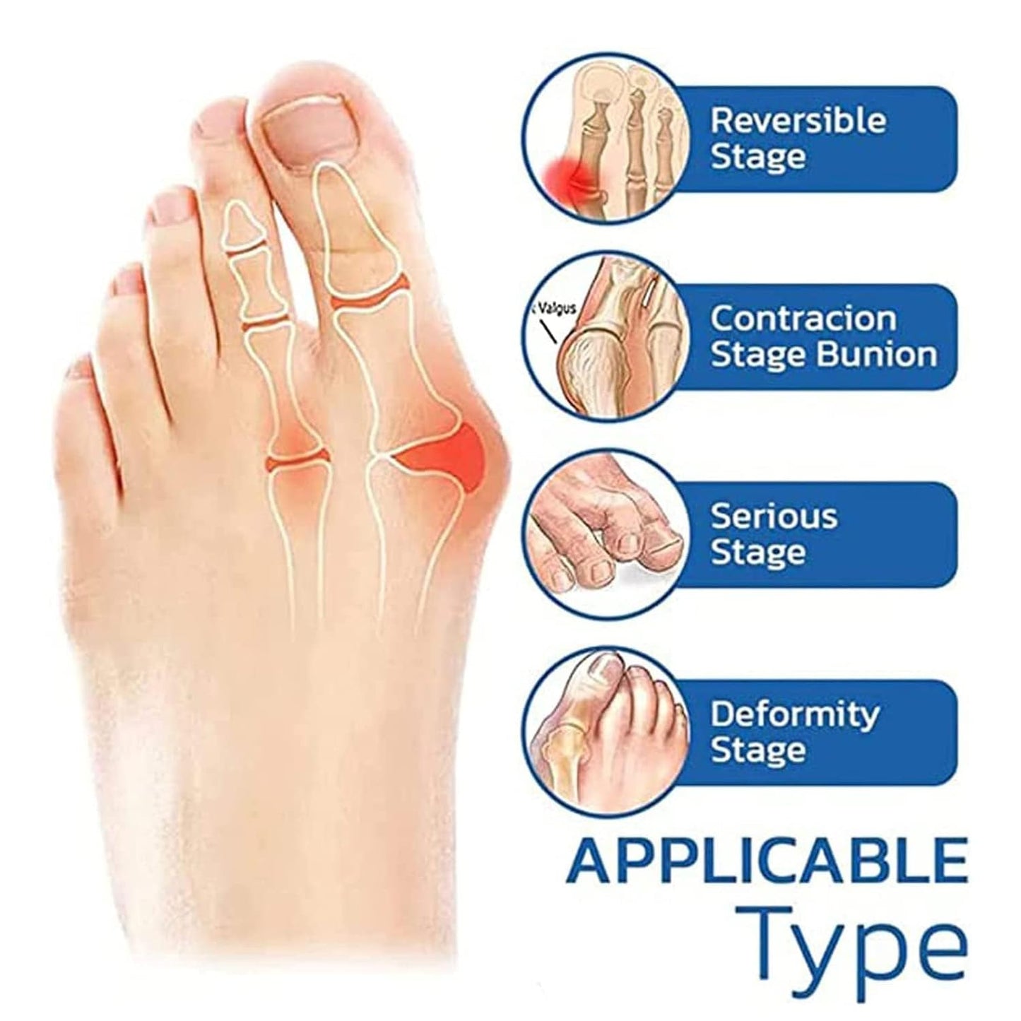Aster 5 Pairs Orthopedic Toe Compression Socks Toe Socks for Women No Show Align Toe Socks for Bunion Low Cut Liner Five Finger Socks with Gel Tab Athletic Breathable Toe Separator Socks for Women